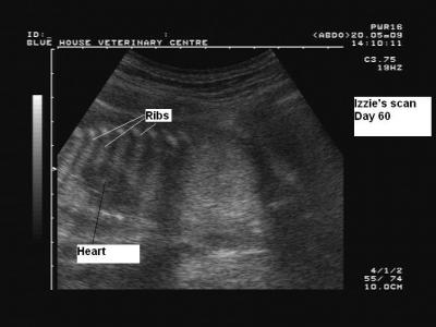 Ultrasound Pregnancy Scan