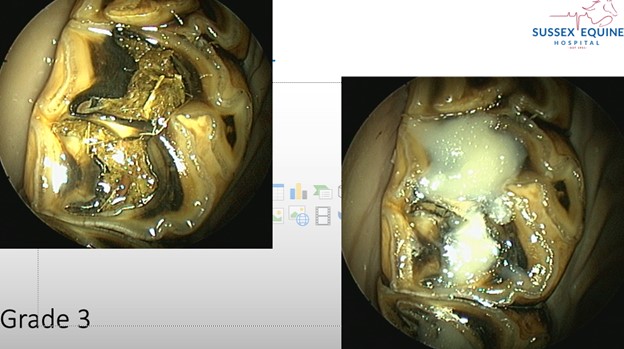 Infundibular restorations