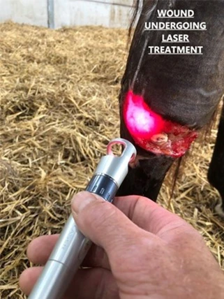 wound undergoing laser treatment