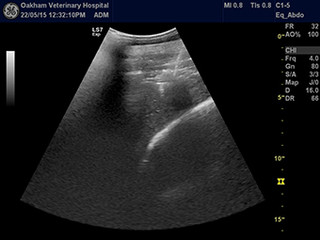 Liver Biopsy