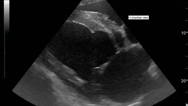 Cardiology chamber 4 ultrasound