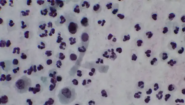 Respiratory cytology