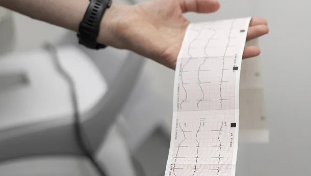 Cardiology ECG